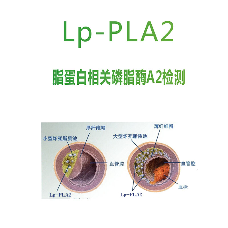 LP-PLA2 脂蛋白相關(guān)磷脂醇A2檢測(cè)